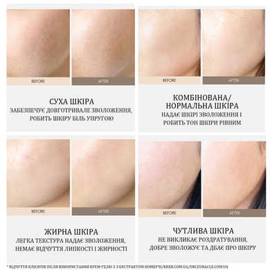 Веганський крем-гель з екстрактом комбучі Vegan Kombucha Tea Gel Cream Dr.Ceuracle 15г